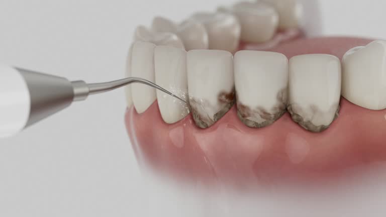 Reliable Root Canal Treatment contractor in Licking County County, OH by Dentist Open Now